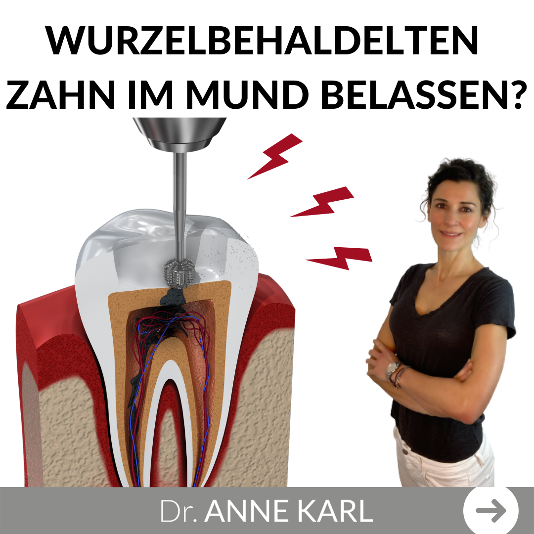 Wurzelbehandelte Zähne