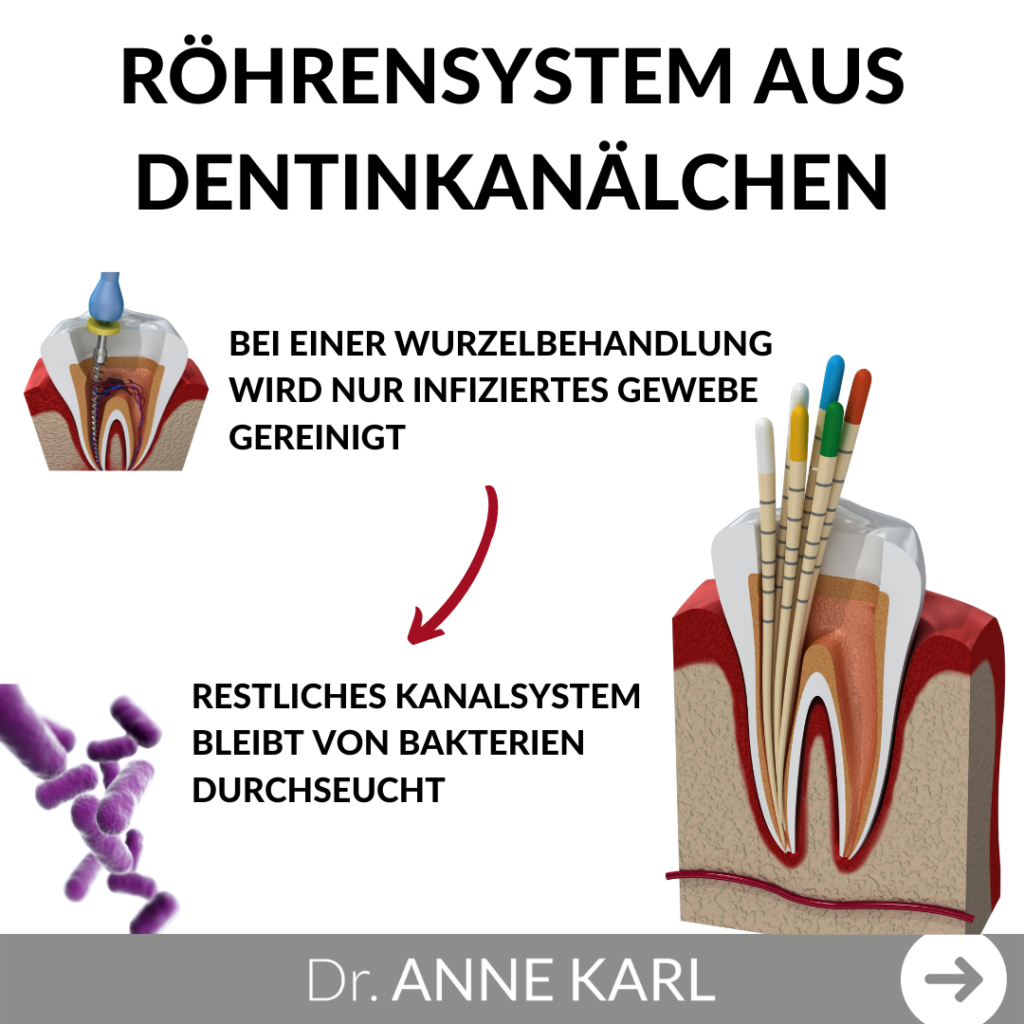 Wurzelbehandelte Zähne Dr. Anne Karl