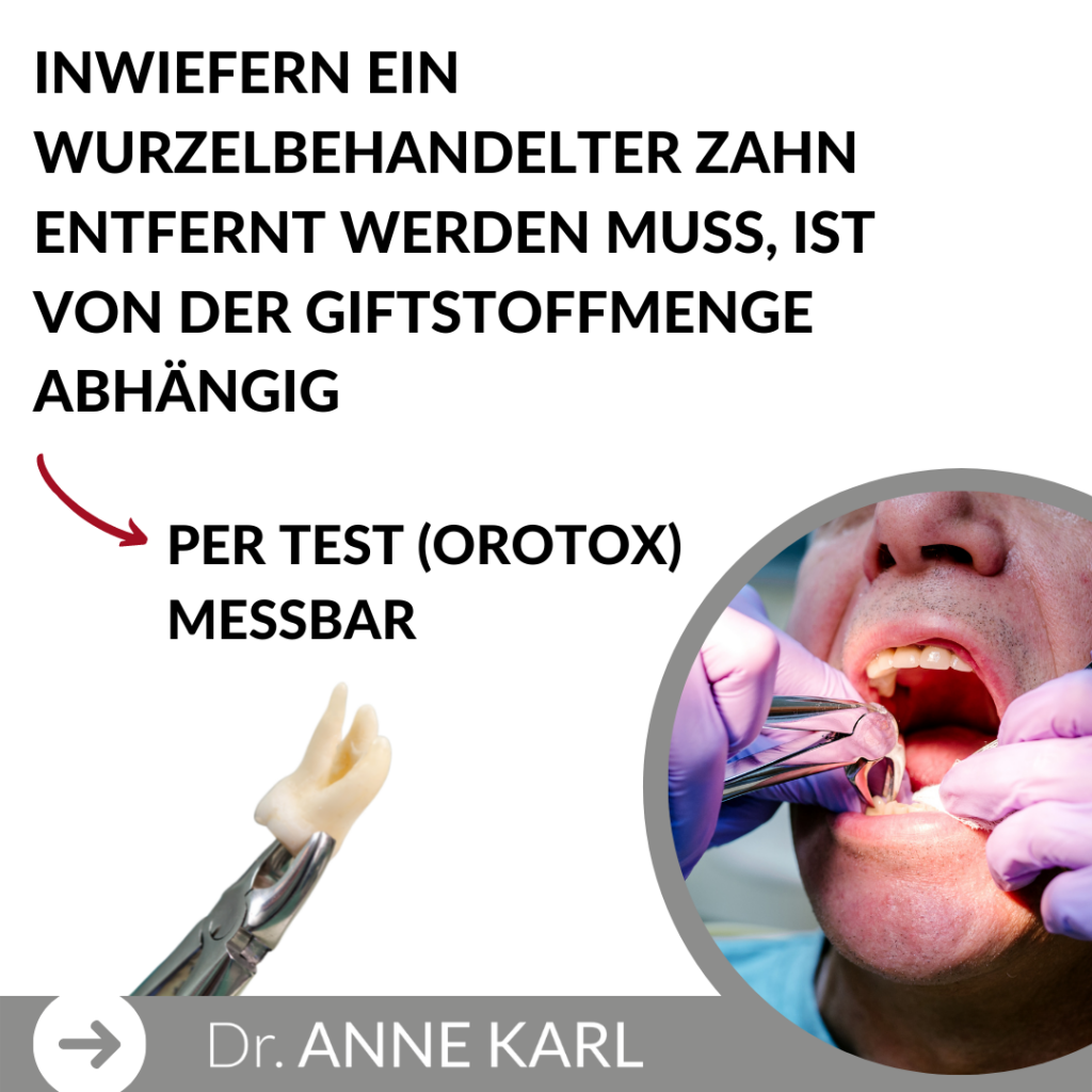 Wurzelbehandelte Zähne Dr. Anne Karl