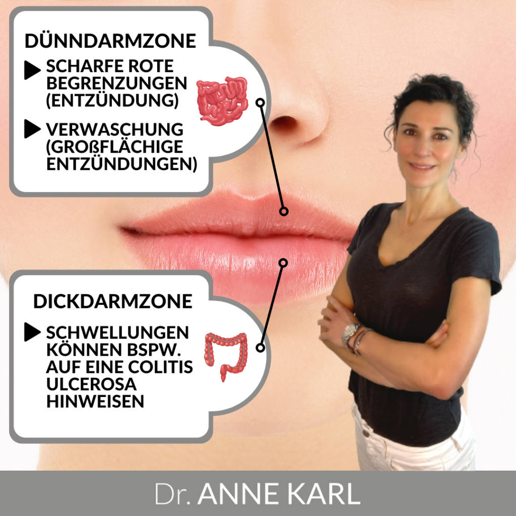 Veränderung der Lippen