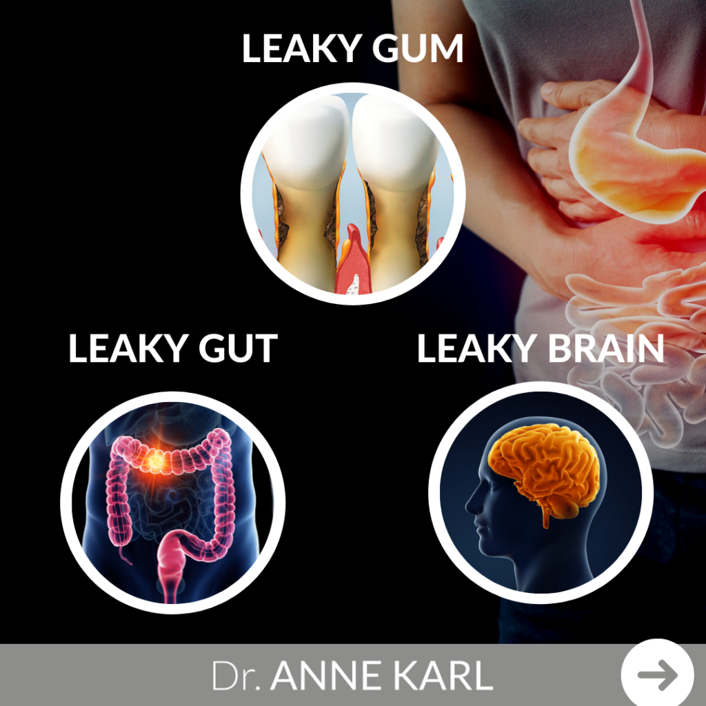 Leaky gum leaky gut leaky brain